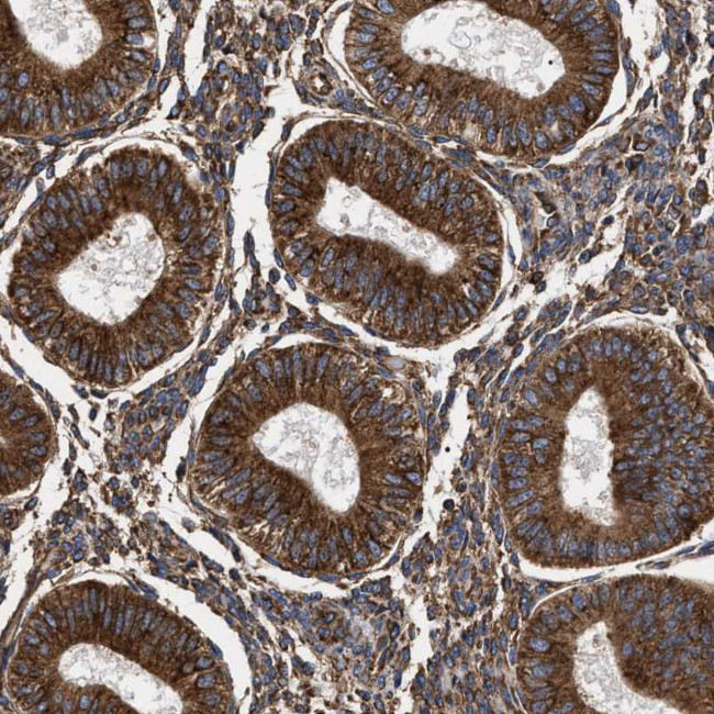 SERBP1 Antibody in Immunohistochemistry (IHC)