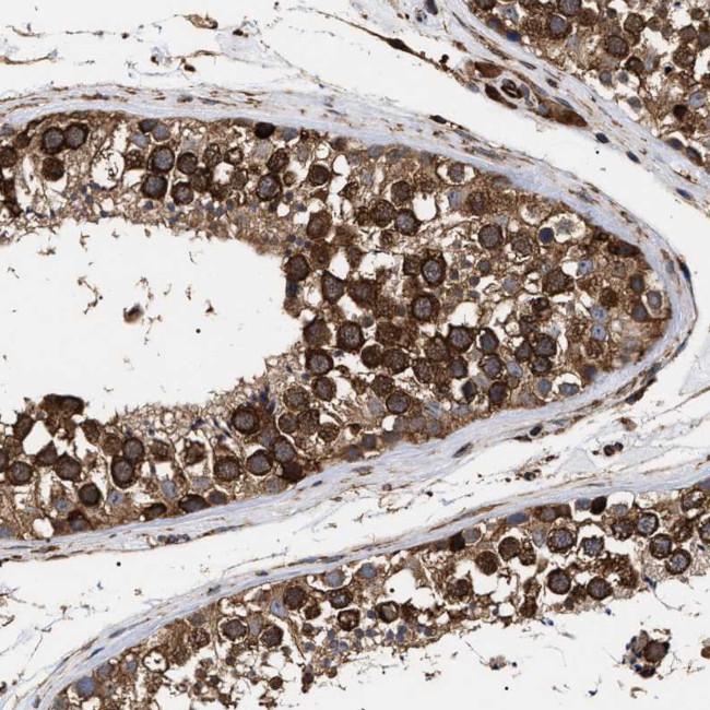 SERBP1 Antibody in Immunohistochemistry (IHC)