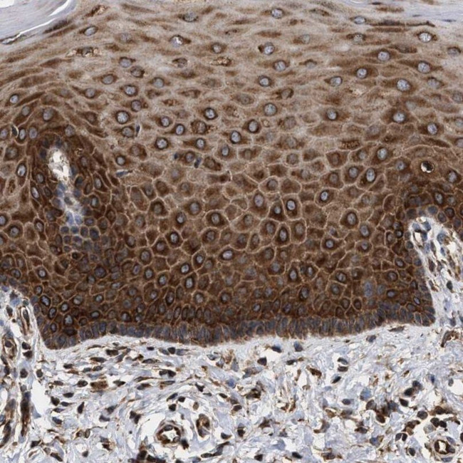 SERBP1 Antibody in Immunohistochemistry (IHC)