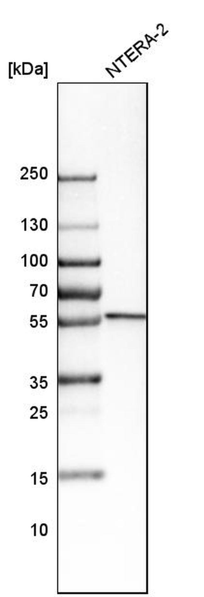 SERBP1 Antibody in Western Blot (WB)