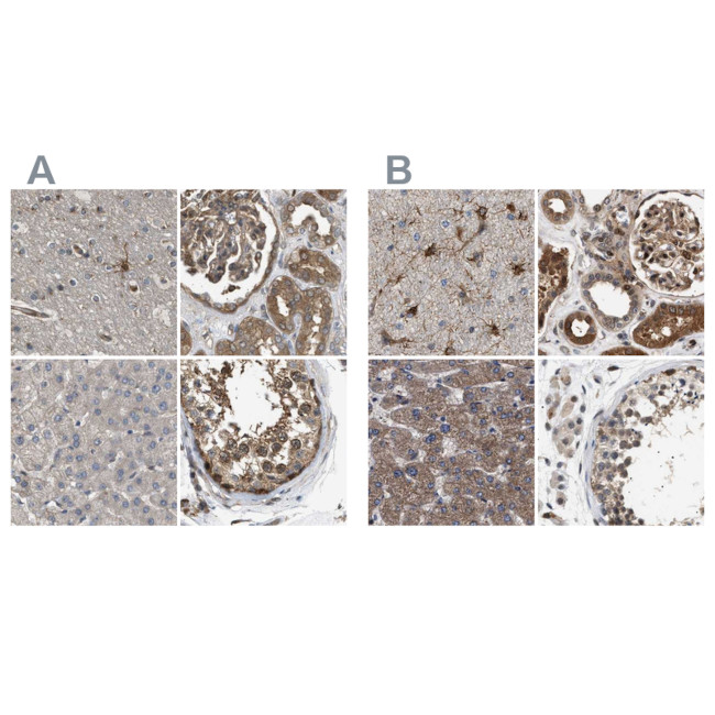 BAG3 Antibody in Immunohistochemistry (IHC)