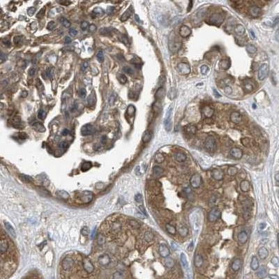 BAG3 Antibody in Immunohistochemistry (IHC)