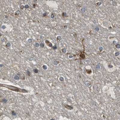 BAG3 Antibody in Immunohistochemistry (IHC)