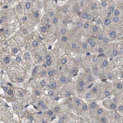 BAG3 Antibody in Immunohistochemistry (IHC)