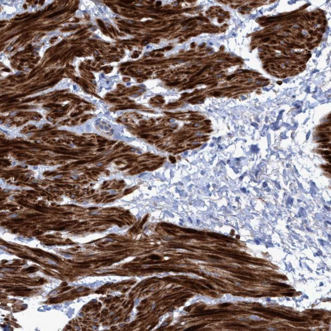 GULP1 Antibody in Immunohistochemistry (IHC)