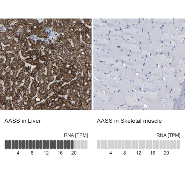 AASS Antibody in Immunohistochemistry (IHC)
