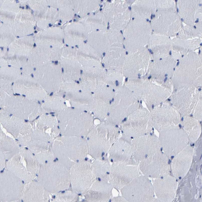 AASS Antibody in Immunohistochemistry (IHC)