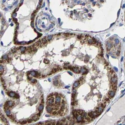 AASS Antibody in Immunohistochemistry (IHC)