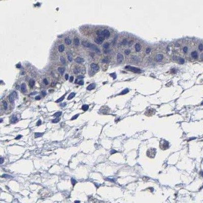 AASS Antibody in Immunohistochemistry (IHC)