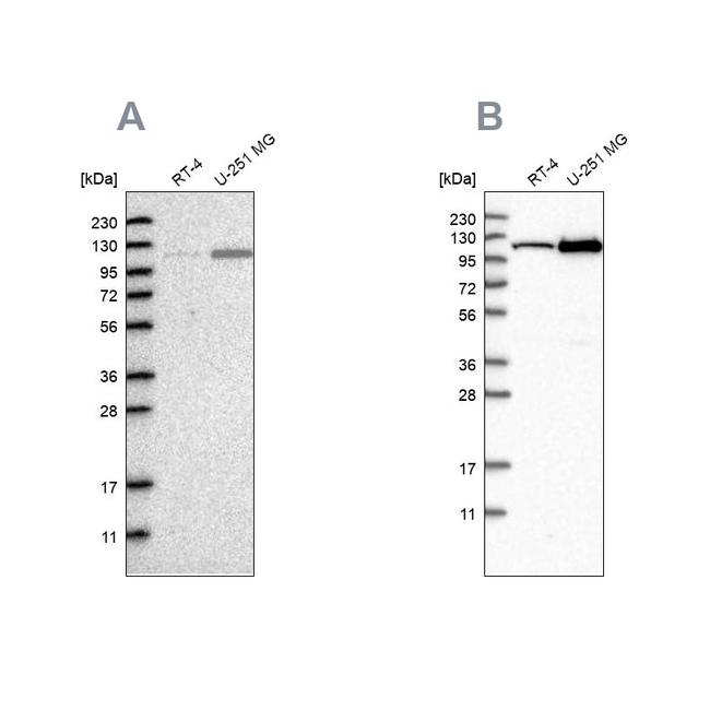 AASS Antibody in Western Blot (WB)