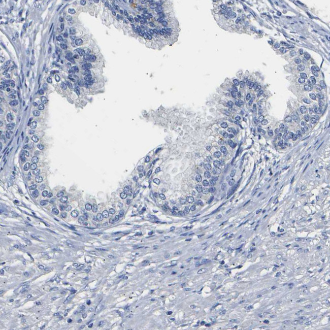 SLCO2B1 Antibody in Immunohistochemistry (IHC)