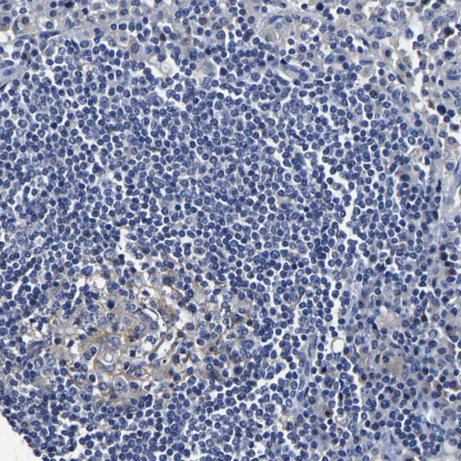 SLCO2B1 Antibody in Immunohistochemistry (IHC)