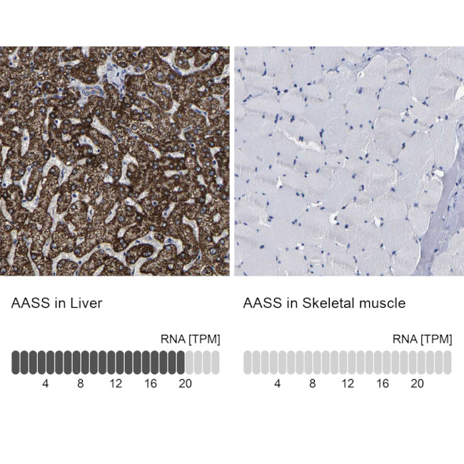 AASS Antibody in Immunohistochemistry (IHC)