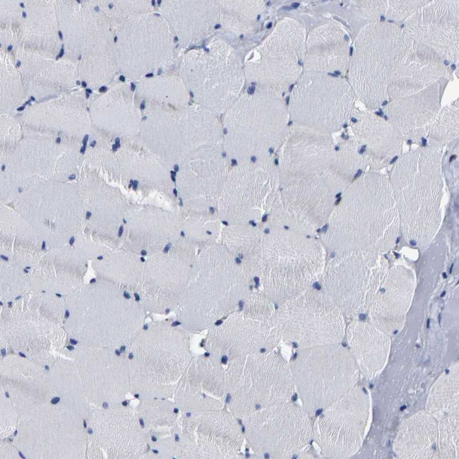 AASS Antibody in Immunohistochemistry (IHC)