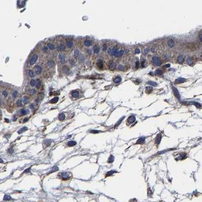 AASS Antibody in Immunohistochemistry (IHC)