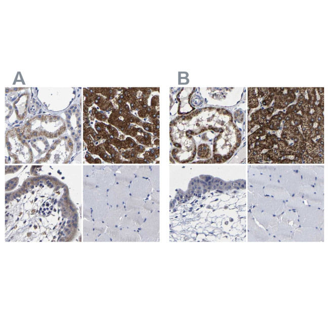 AASS Antibody in Immunohistochemistry (IHC)