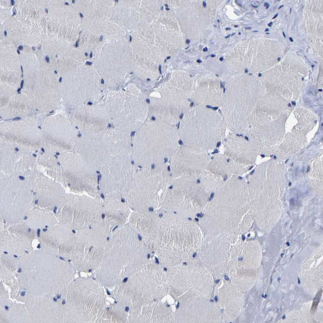 AASS Antibody in Immunohistochemistry (IHC)