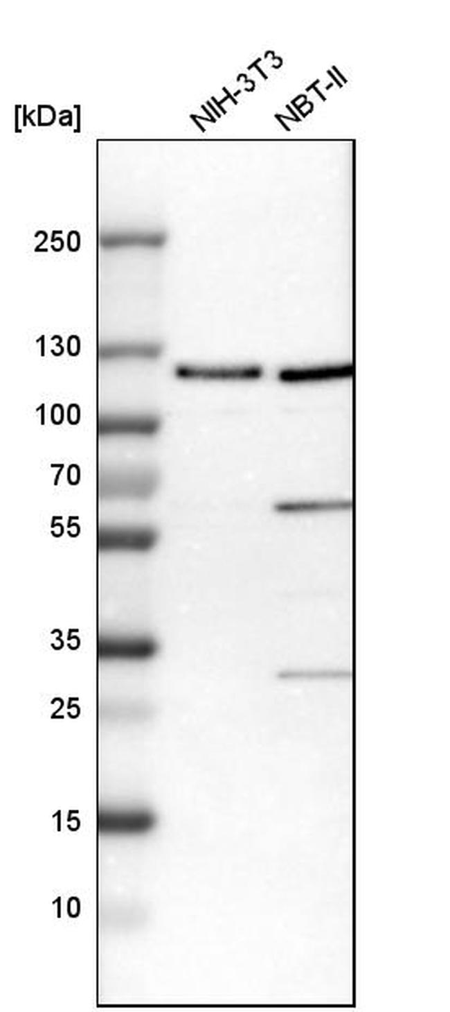 AASS Antibody in Western Blot (WB)