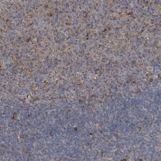 BCL2L12 Antibody in Immunohistochemistry (IHC)