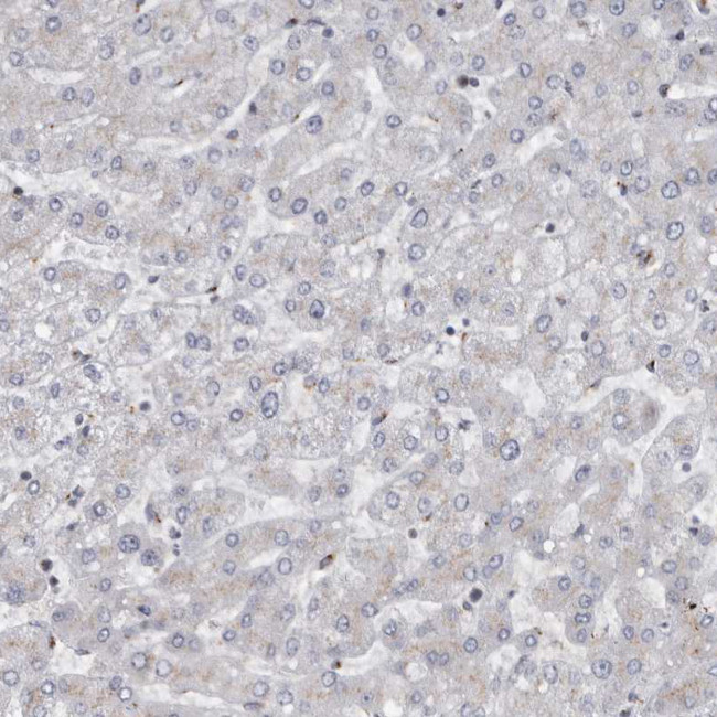 ZMYND8 Antibody in Immunohistochemistry (IHC)