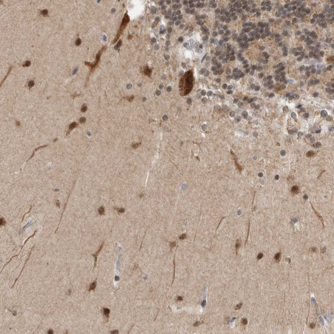 ZMYND8 Antibody in Immunohistochemistry (IHC)