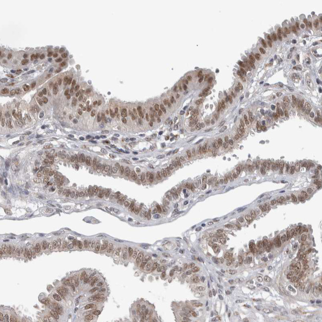 ZMYND8 Antibody in Immunohistochemistry (IHC)