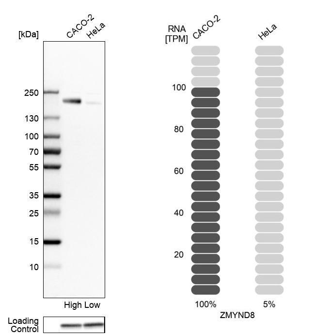 ZMYND8 Antibody in Western Blot (WB)