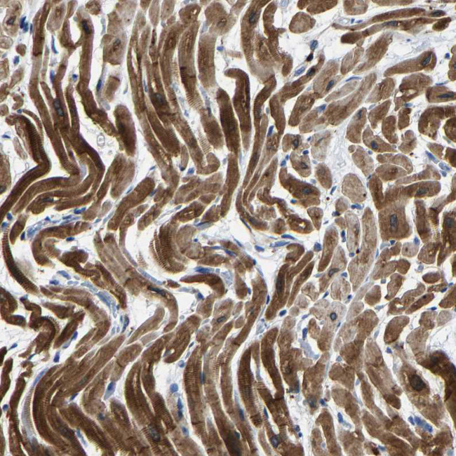 AGK Antibody in Immunohistochemistry (IHC)