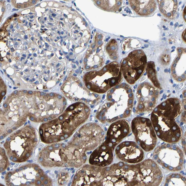 AGK Antibody in Immunohistochemistry (IHC)