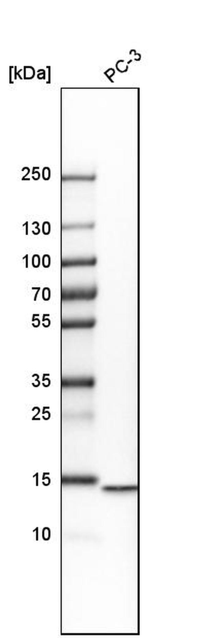 HINT2 Antibody in Western Blot (WB)