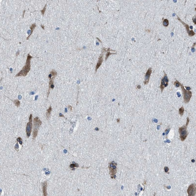 NACAD Antibody in Immunohistochemistry (IHC)