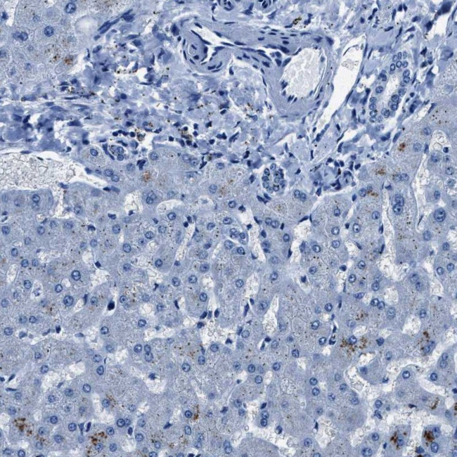 NACAD Antibody in Immunohistochemistry (IHC)