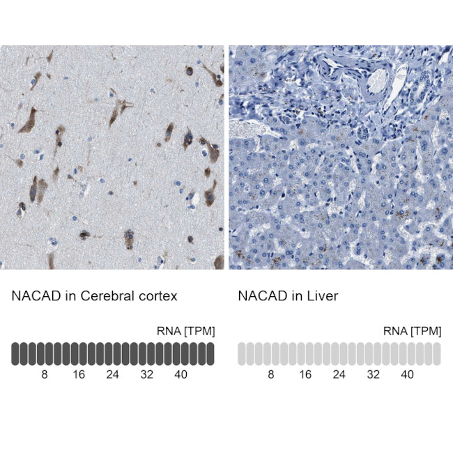 NACAD Antibody