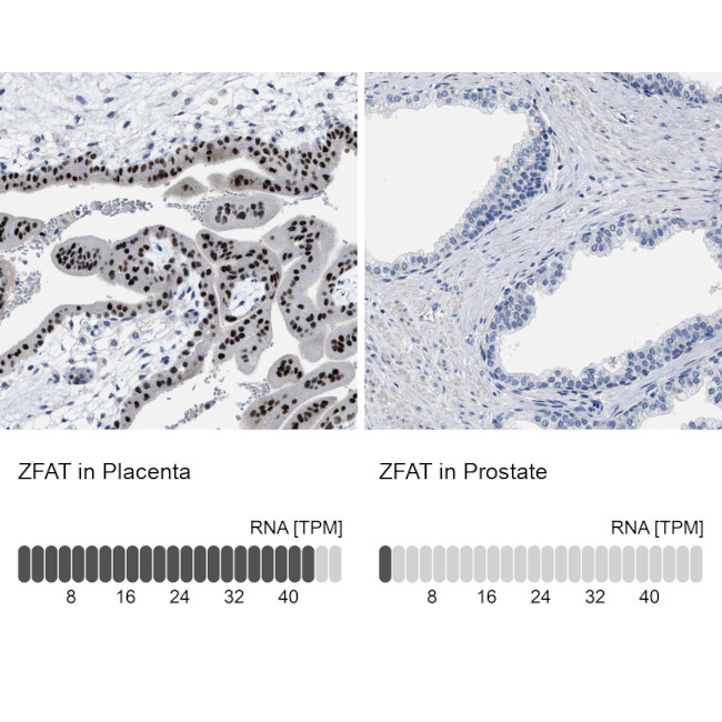 ZFAT Antibody in Immunohistochemistry (IHC)