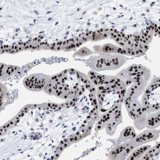 ZFAT Antibody in Immunohistochemistry (IHC)