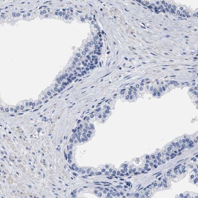 ZFAT Antibody in Immunohistochemistry (IHC)