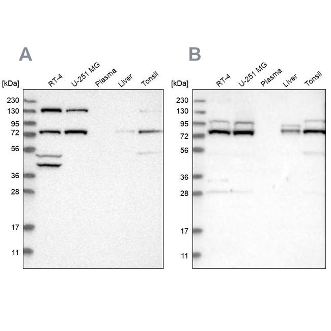 PLAA Antibody in Western Blot (WB)