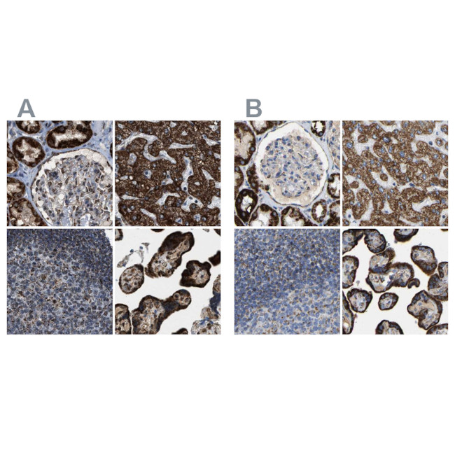 HIBADH Antibody in Immunohistochemistry (IHC)