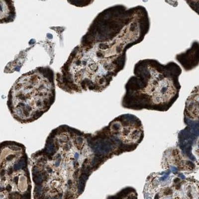 HIBADH Antibody in Immunohistochemistry (IHC)