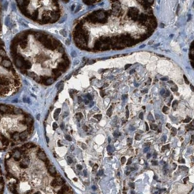 HIBADH Antibody in Immunohistochemistry (IHC)