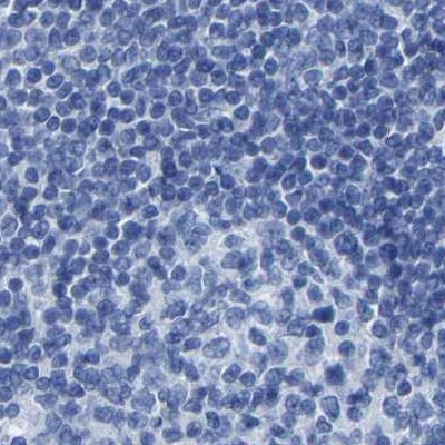 MYBPC1 Antibody in Immunohistochemistry (IHC)