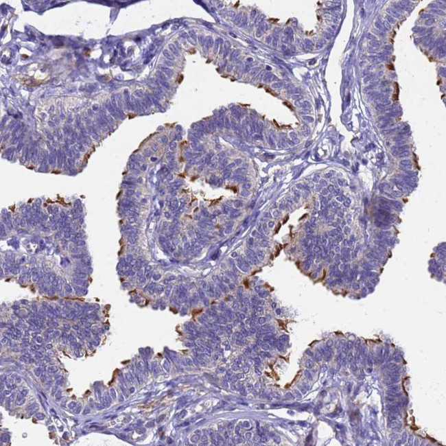 POP7 Antibody in Immunohistochemistry (IHC)