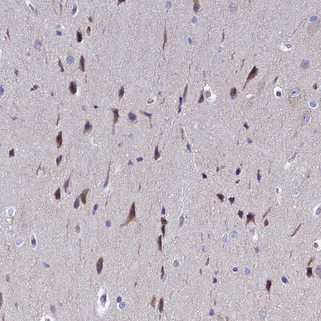 POP7 Antibody in Immunohistochemistry (IHC)