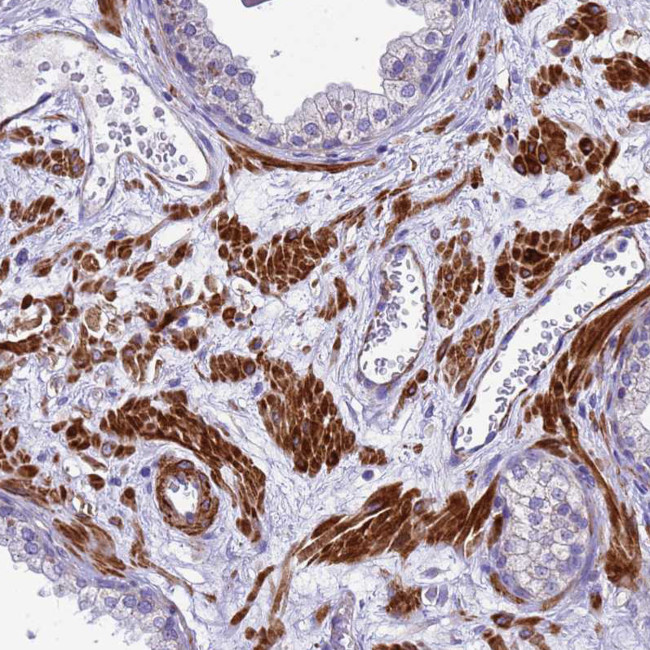 POP7 Antibody in Immunohistochemistry (IHC)