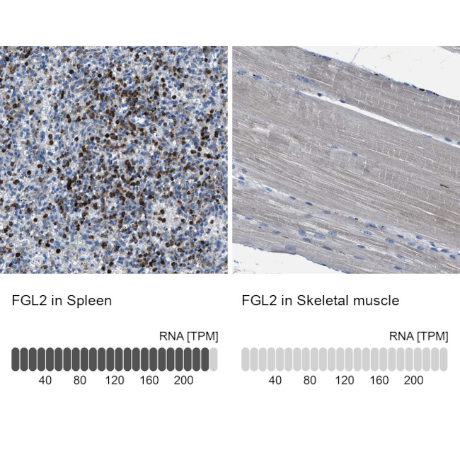 FGL2 Antibody in Immunohistochemistry (IHC)