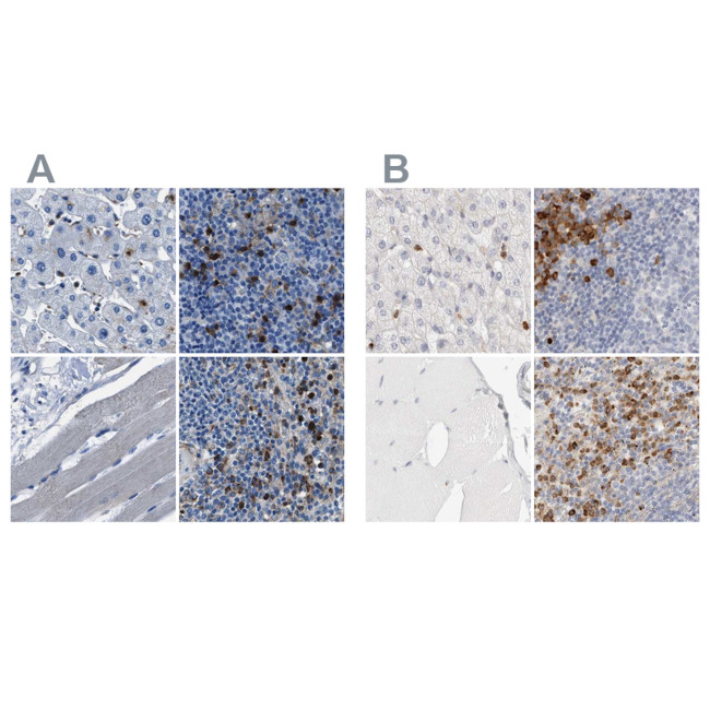 FGL2 Antibody in Immunohistochemistry (IHC)