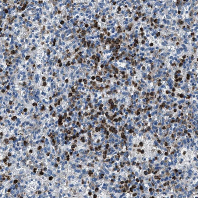 FGL2 Antibody in Immunohistochemistry (IHC)