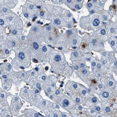 FGL2 Antibody in Immunohistochemistry (IHC)