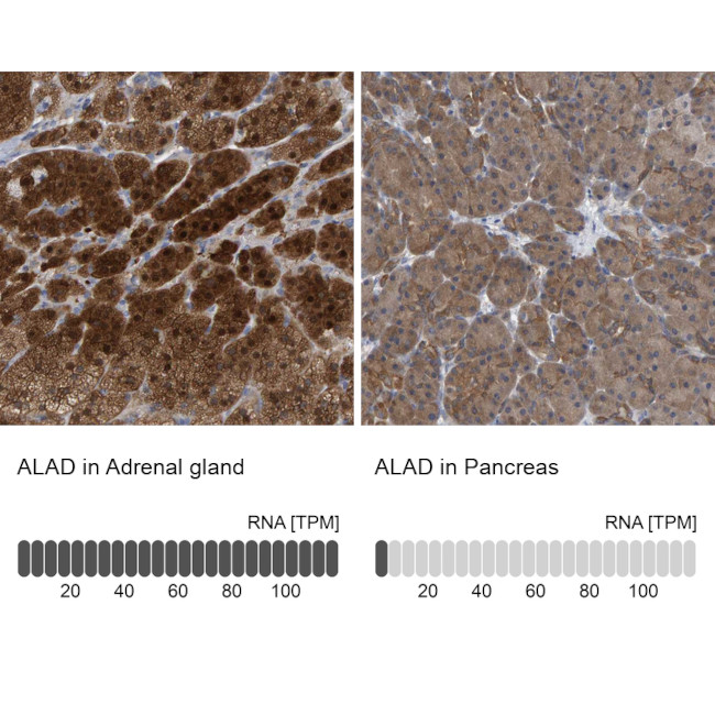 ALAD Antibody in Immunohistochemistry (IHC)