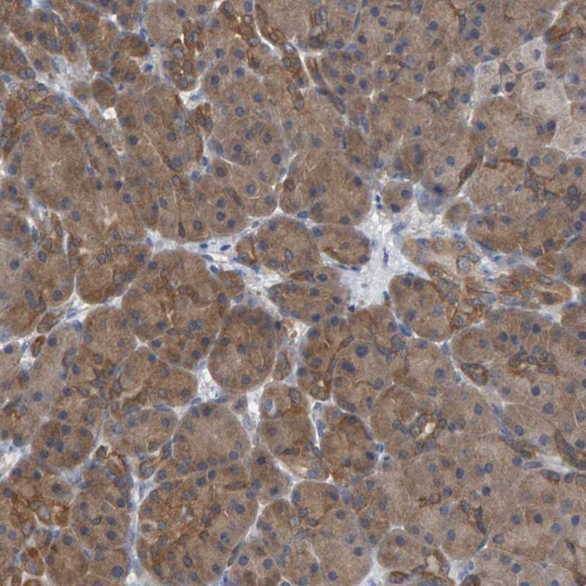 ALAD Antibody in Immunohistochemistry (IHC)